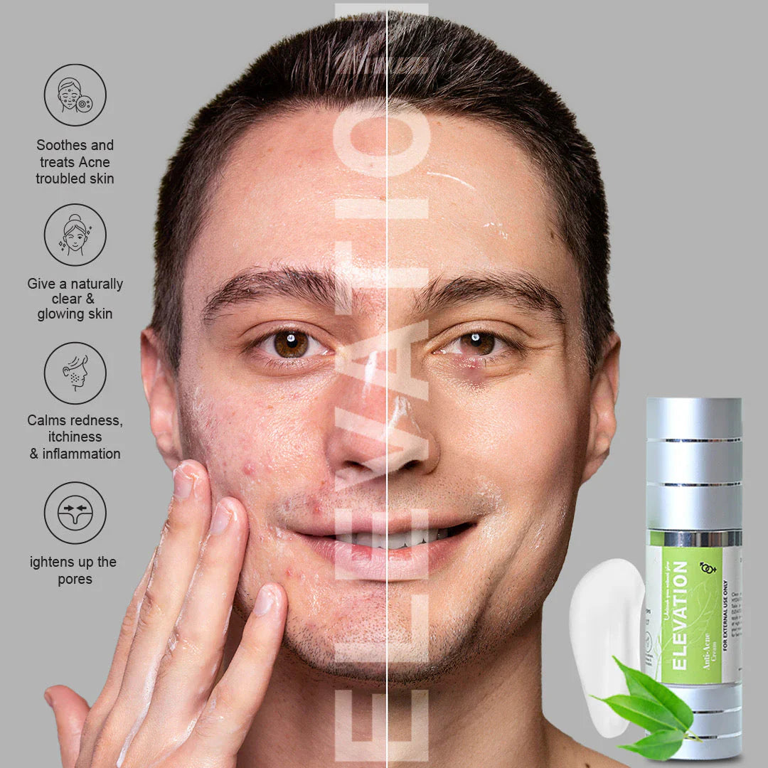 #1 Anti Acne Cream Pakistan