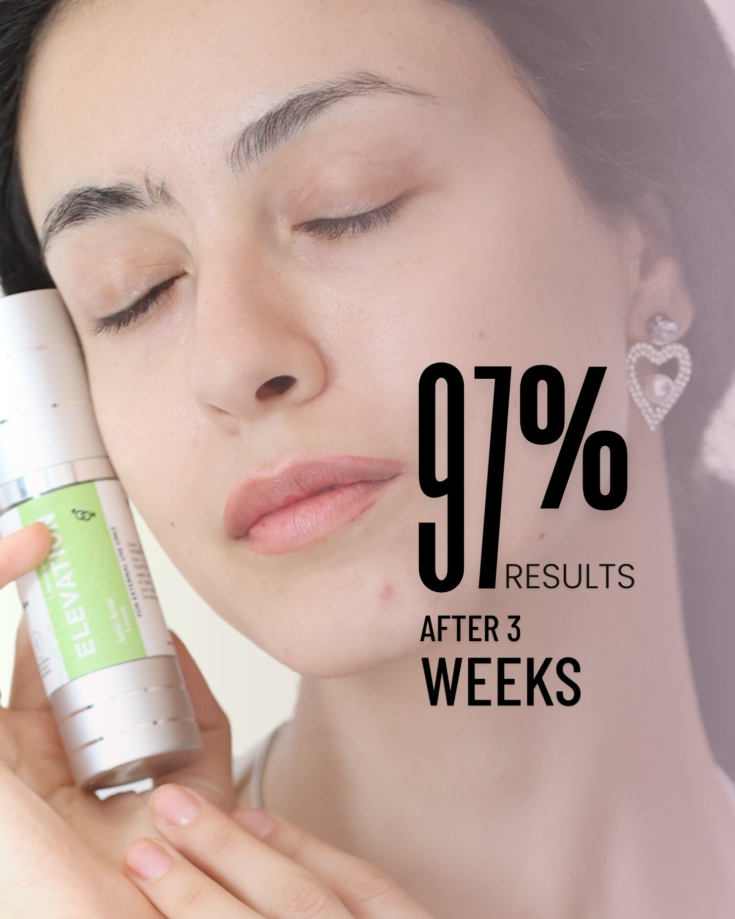 Anti Acne Cream Elevation Beauty