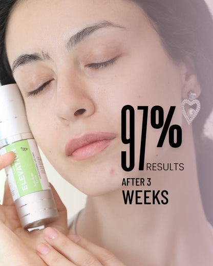 Anti Acne Cream Elevation Beauty