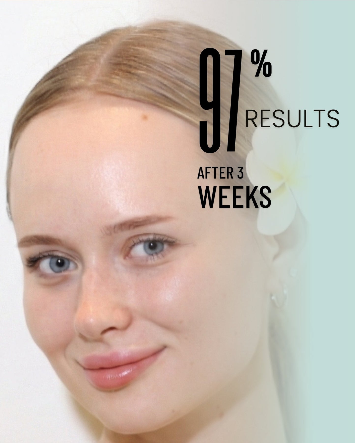 Elevation Beauty Vitamin C Serum ingredients, Ascorbyl Glucoside and Hyaluronic Acid