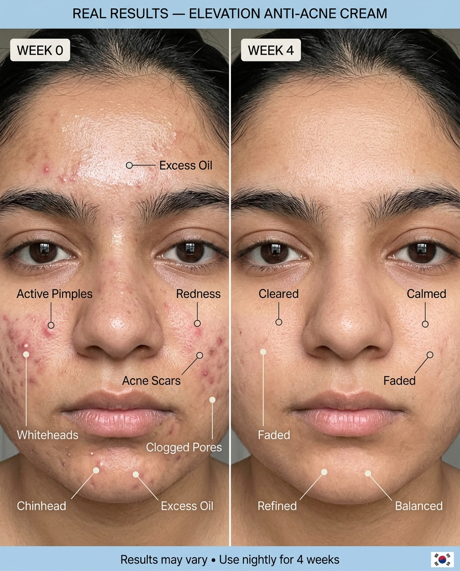 Complete Skin Care Bundle – Your All-in-One Solution for Radiant Skin Elevation Beauty