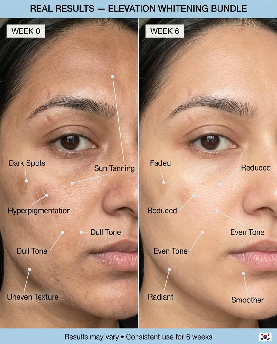Whitening Bundle Elevation Beauty